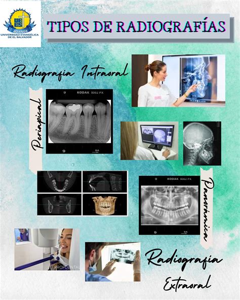 Tipos de Radiografías Dentales by Jessica Morales Issuu