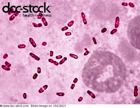 Yersinia Pestis Pasteurella Pestis Is The Bacterium Responsible For