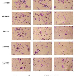 Effect Of Tctp On The Activation Of Nf B In Lovo Cells Expression