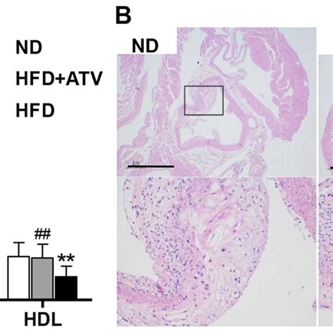 Atherosclerotic Lesion Formation In Aortic Sections From Apoe Mice