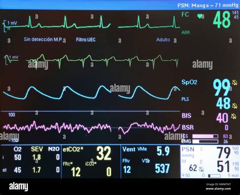 Vital Signs Screen Surgery Operating Room Onkologikoa Hospital