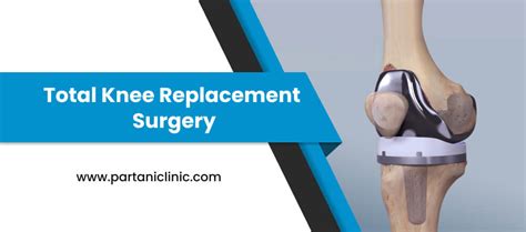 Total Knee Replacement Surgery In Jaipur Tkr Surgery Dr Arun Partani