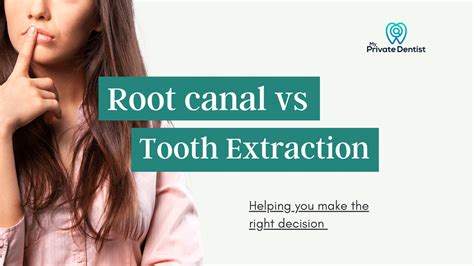 Root Canal Vs Extraction Making The Right Choice For You Costs And