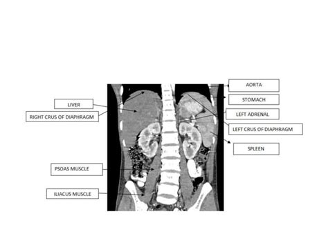 Kub anatomy | PPT