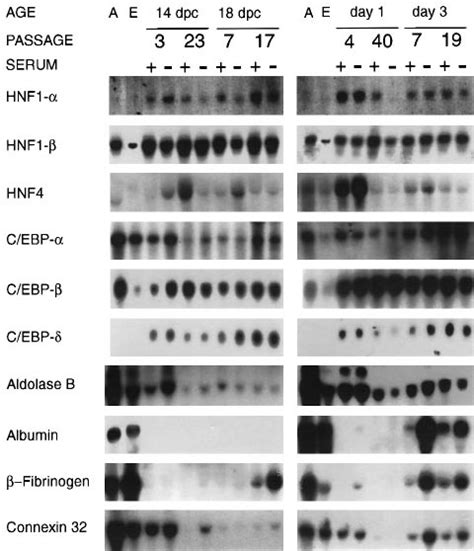 Characterization Of Liver Gene Expression In Mmh Northern Download