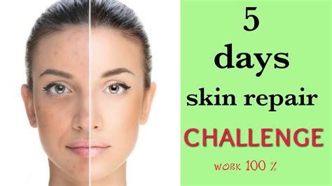 7 Days Skin Repair Challenge Glowing Healthy Skin In 7 Days YouTube