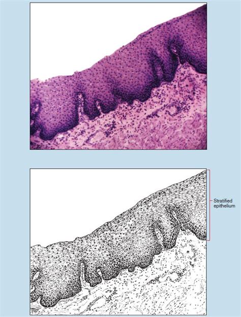 Stratified Squamous Epithelium Slide Labeled