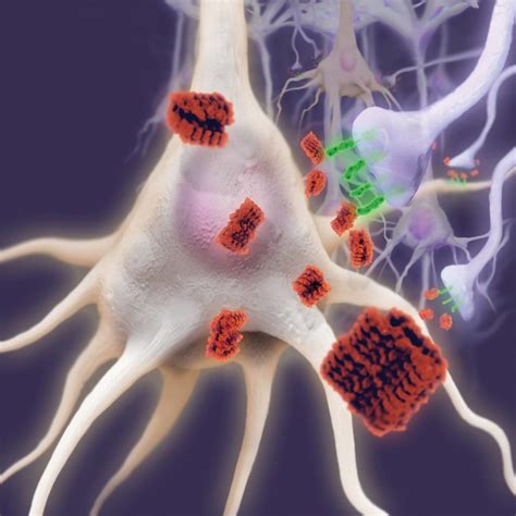 Β AMILOIDE Y ALZHEIMER Enriquerubio net