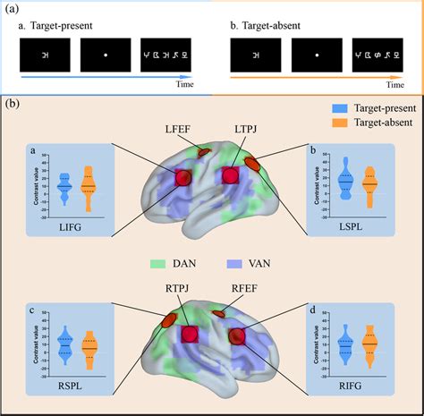 Comparisons Of Brain Activations Between The Two Conditions Of Target