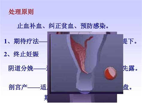 妊娠晚期出血性疾病word文档在线阅读与下载无忧文档