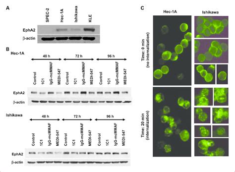 Epha Expression In Endometrial Cancer Cell Lines And The Assessment Of