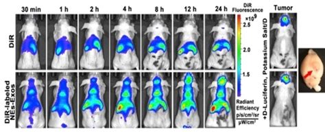 SPECT CT Imaging Of Free 111 In DTPA Complex And 111 In DTPAlabeled