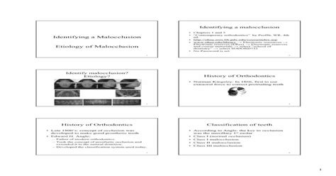 Identifying A Malocclusion Etiology Of Malocclusion A Malocclusionpdfmixed Dentition Class I 8