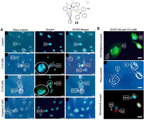 Frontiers Organometallic Gold I And Gold Iii Complexes For Lung