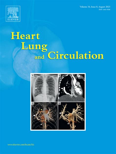 Sex Disparities In Myocardial Infarction Biology Or Bias Heart Lung And Circulation