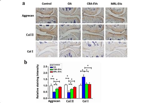 Immunohistochemical Staining For Type Ii Collagen Type I Collagen And