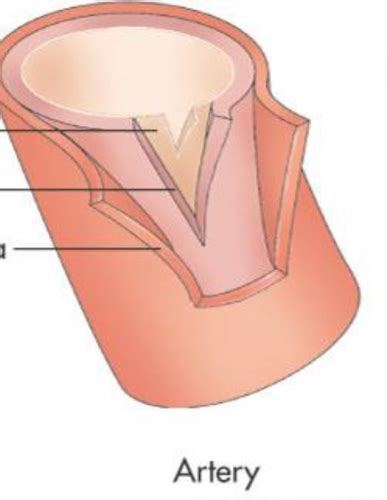 Vascular Test 1 Flashcards Quizlet