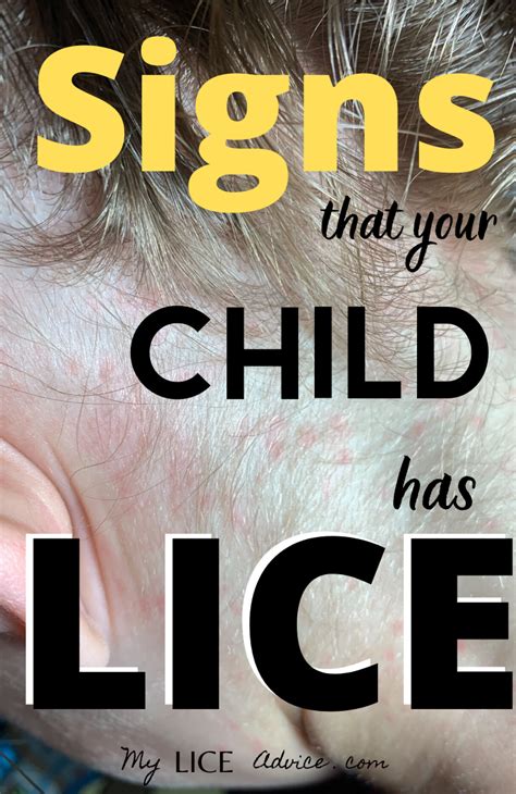 How To Check For Lice Video Tutorial Artofit