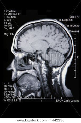 Real Mri/ Mra ( Image & Photo (Free Trial) | Bigstock