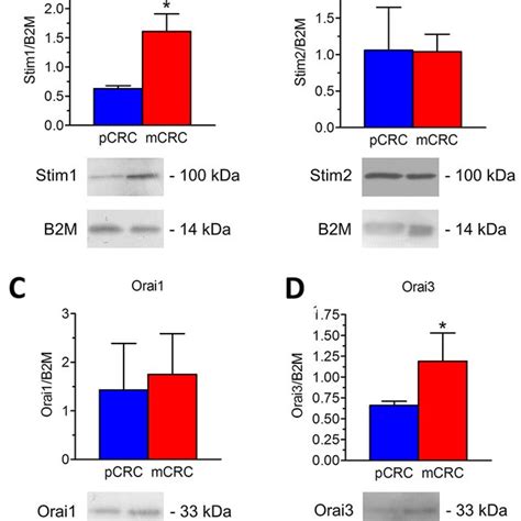 Expression Of Stim And Orai Transcripts In Patients Derived