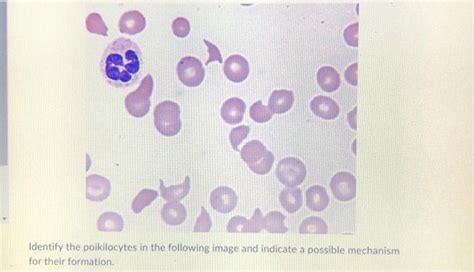 Identify The Poikilocytes In The Following Image And Chegg