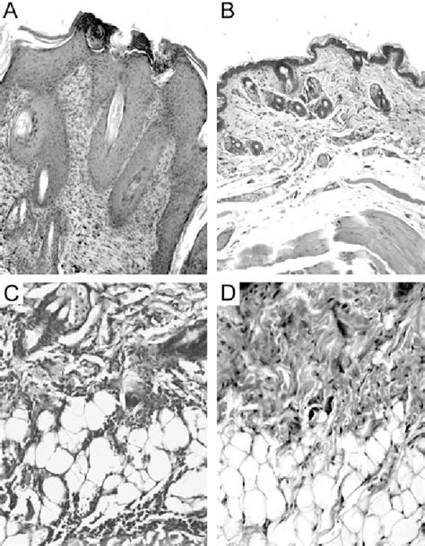 Figure From Differential Roles Of Icam And Vcam In Leukocyte