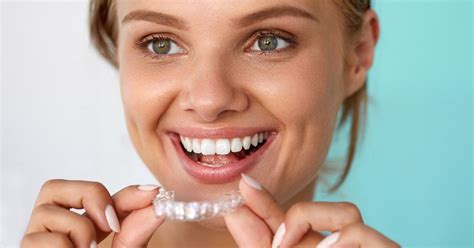 The Invisalign Timeline How Long Does It Take For Invisalign To Work