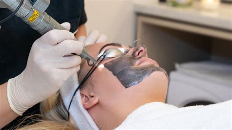 Iconic Medispa Hollywood Laser Peel