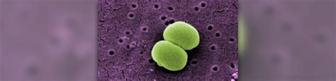 Symptoms of staphylococcus aureus | General center | SteadyHealth.com