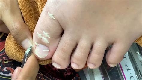 How To Cut Thick Toenails Toenail Cleaning Satisfying Youtube