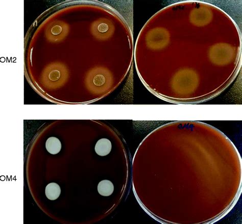 Photographs Showing The Hemolysis Of Sheep Blood Agar Induced By The