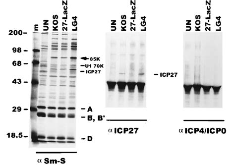 Immunoprecipitation Of 35 S Methionine Labeled Proteins In Uninfected