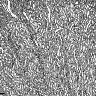 Control Group Renal Cortex 10X Obj Goldners Trichrome Stain