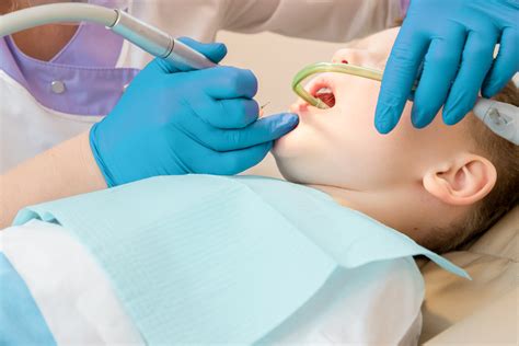 Benefits Of Nitrous Oxide All Stars Pediatric Dentistry