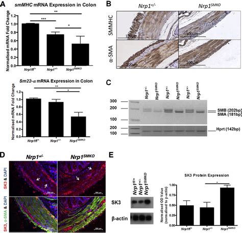 Loss Of Nrp1 In SMC Affects The Expression Of Markers Of Contractile