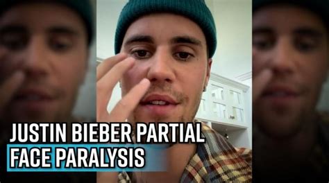 Justin Bieber Experiencing Facial Paralysis Shares A Faint Smile