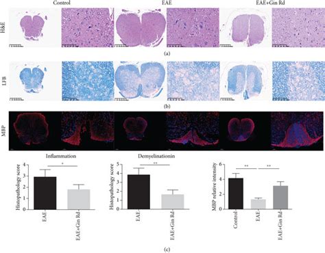 Ginsenoside Rd Treatment Ameliorated The Severity Of Eae Via Inhibiting