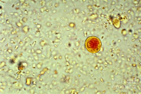 Entamoeba Histolytica Cyst 1 Photograph By Science Source Fine Art America