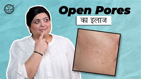 How To Treat Open Pores Best Treatment Options Available For Open