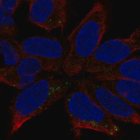 Anti DCC Antibody Produced In Rabbit