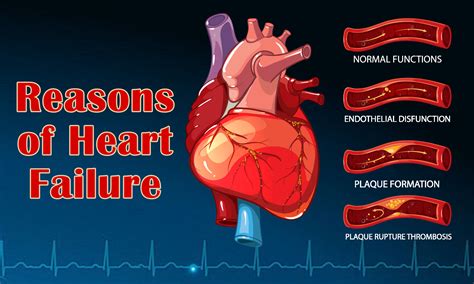 treatment  heart failure professor akm manzurul alam