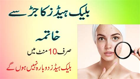 Blackhead Khatam Karne Ka Asan Ghrelu Nuskha Remove Blackheads From