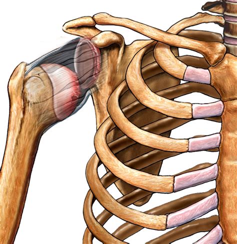 Separated Shoulder