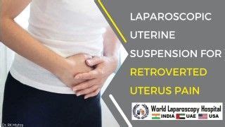 Laparoscopic Myomectomy For Large Fibroid Uterus And Cholecystectomy In