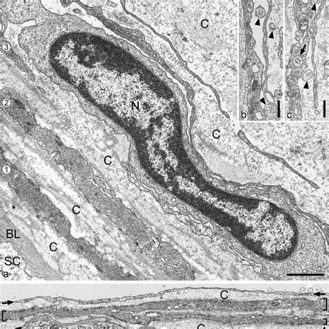 Electron Micrographs Of Ultrathin Cross Sections Through The Peripheral