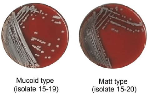 Colony Phenotypes Matt And Mucoid Of The K Pneumoniae Isolates