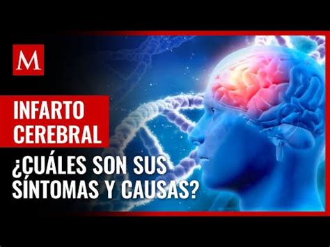 Edema Cerebral Todo Lo Que Necesitas Saber Sobre Tipos S Ntomas