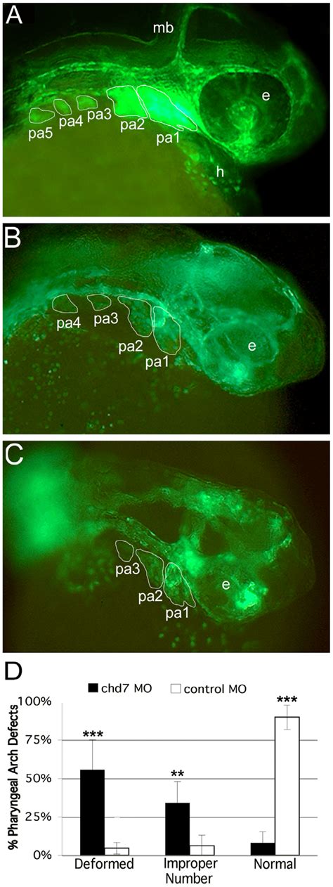 Knockdown Of Chd Results In Defects In Cnc Development Fli Gfp