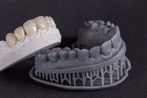 The Advancements In 3d Printing For Dental Applications 3d Dentistry Bradenton Fl