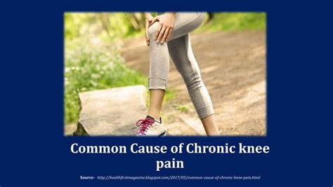 Common Cause Of Chronic Knee Pain Ppt